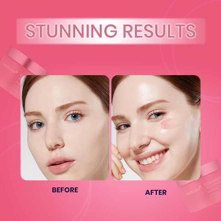 Collagen Niacinamide Jelly Cream