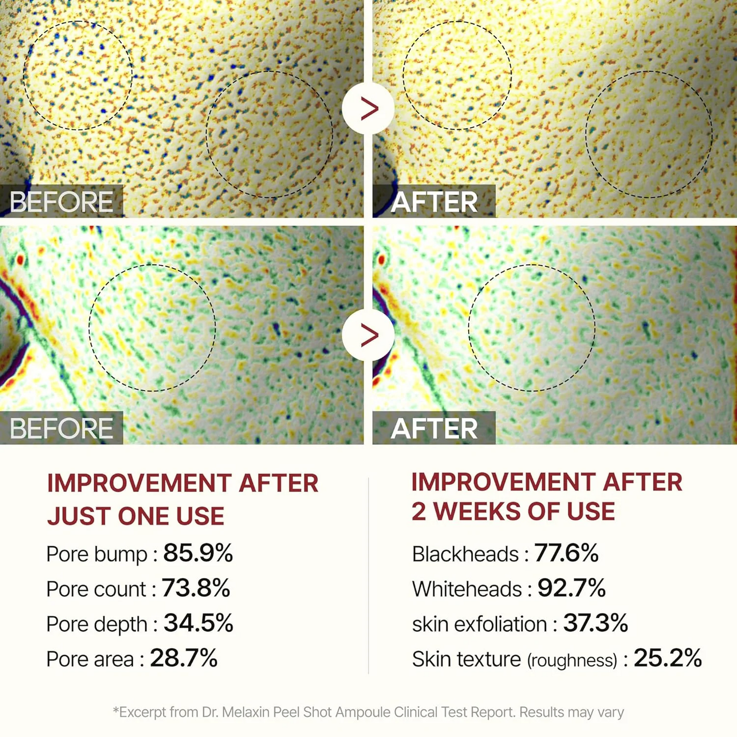 Pack of 2 Dr. Melaxin Peel Shot Exfoliant Rice Ampoule